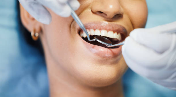 Best Emergency Root Canal Treatment in Wymore, NE