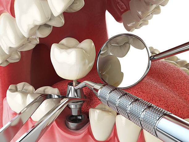 Best Emergency Treatment for Toothache in Wymore, NE